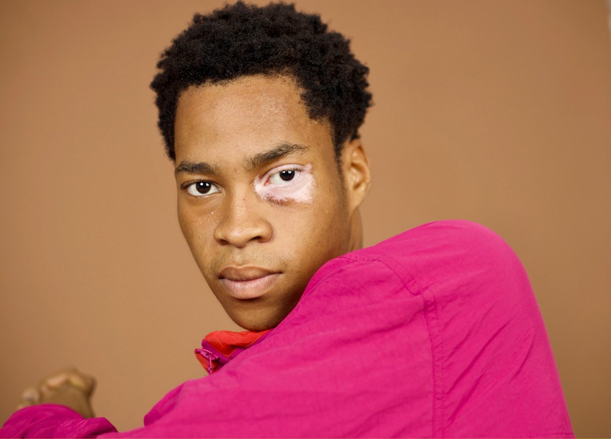 Body Besties Portrait of Man with Vitiligo